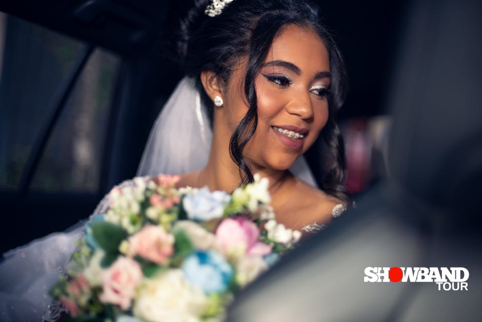 wedding teeth whitening